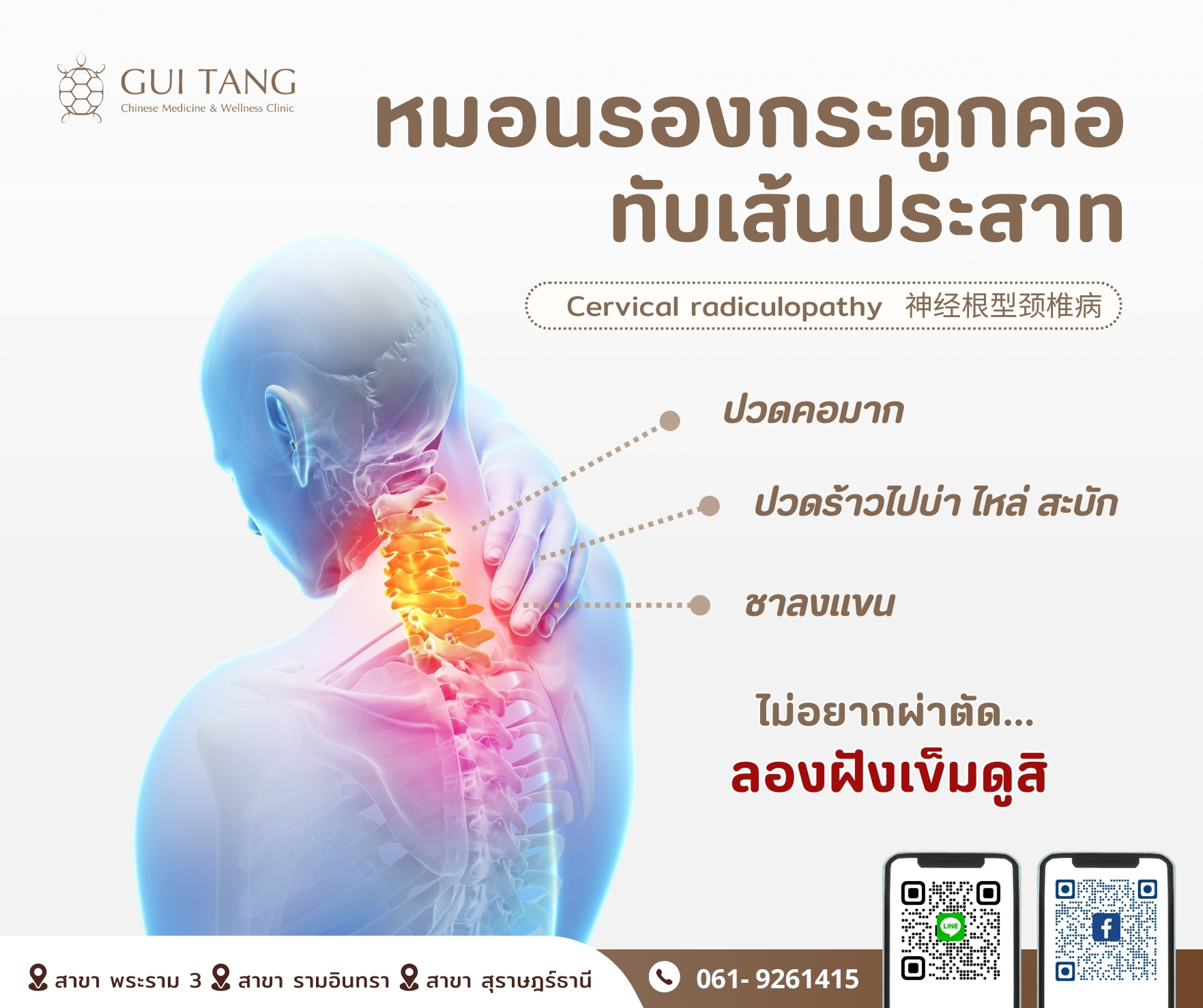 หมอนรองกระดูก “คอ” กดทับเส้นประสาท