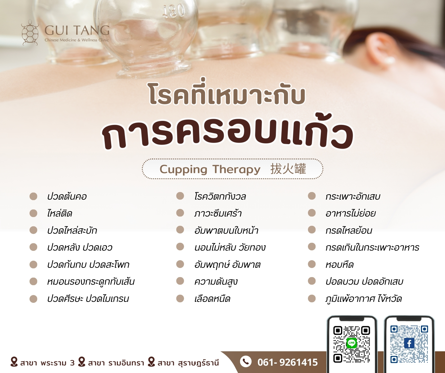 โรคที่เหมาะกับการครอบแก้ว (Cupping Therapy)