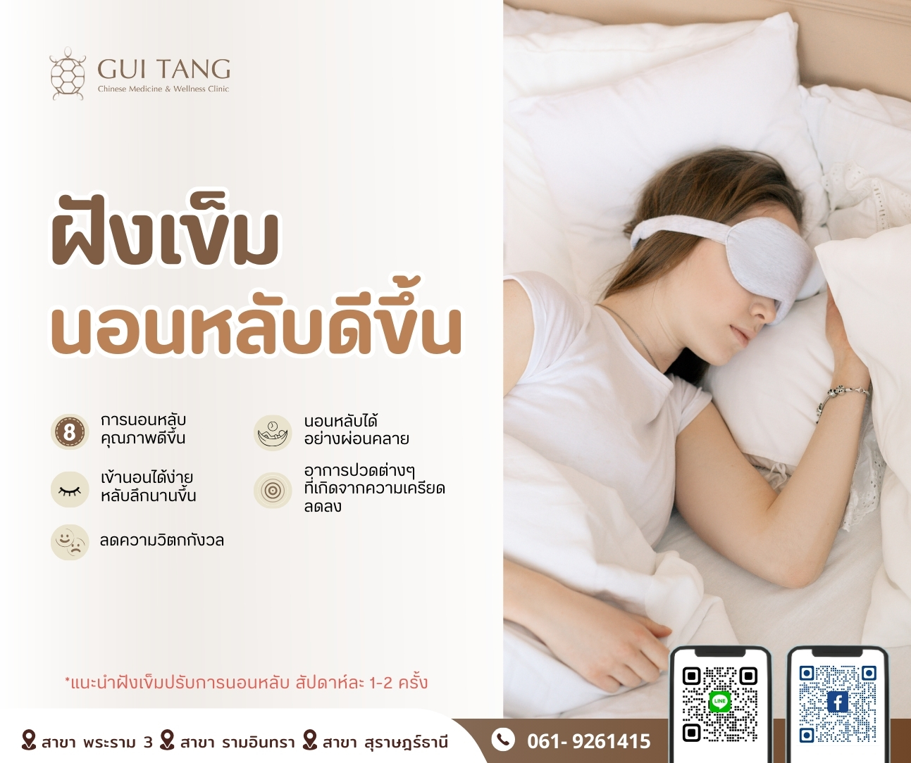 ฝังเข็ม นอนหลับดีขึ้น