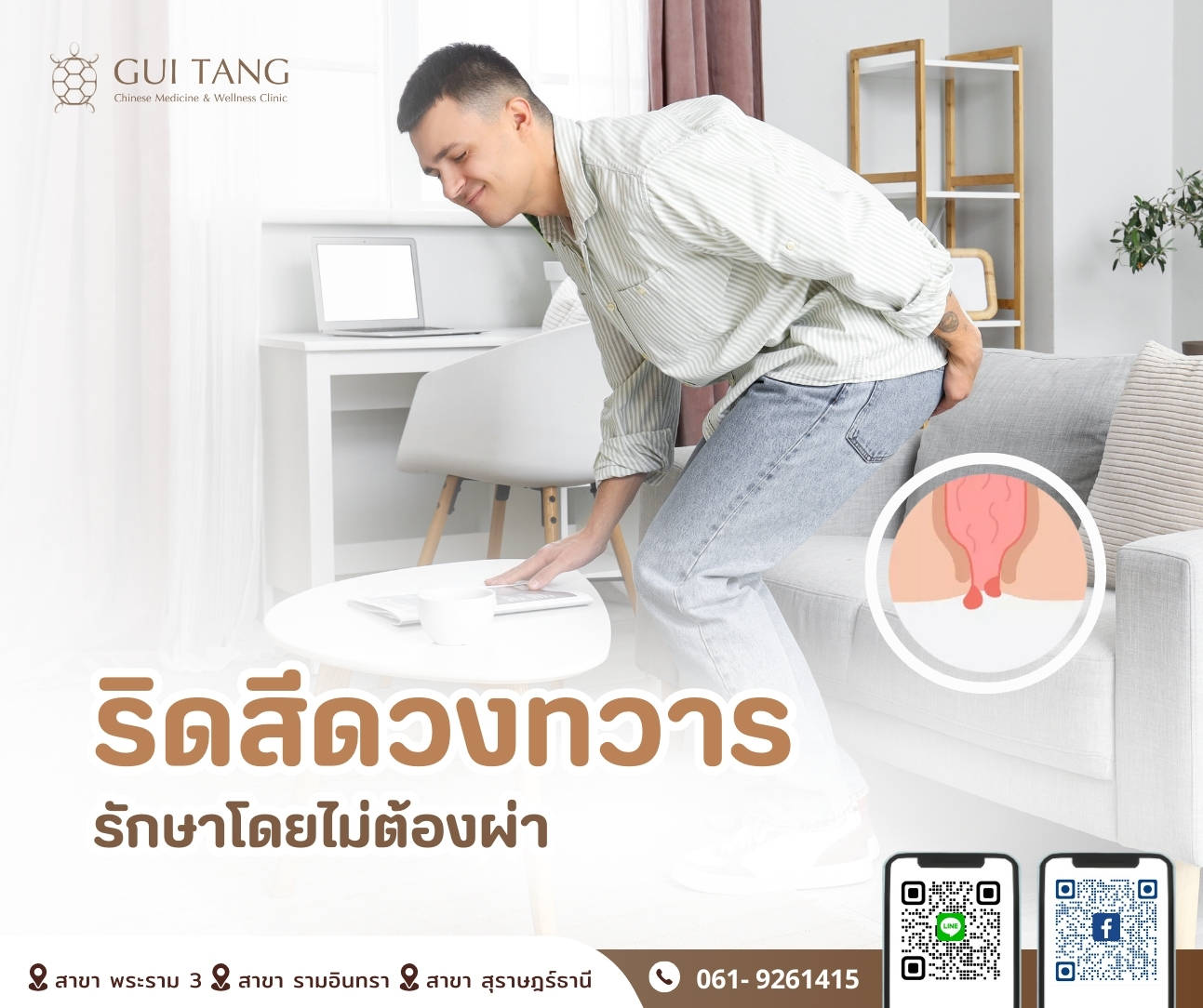 ริดสีดวงทวาร รักษาโดยไม่ต้องผ่า