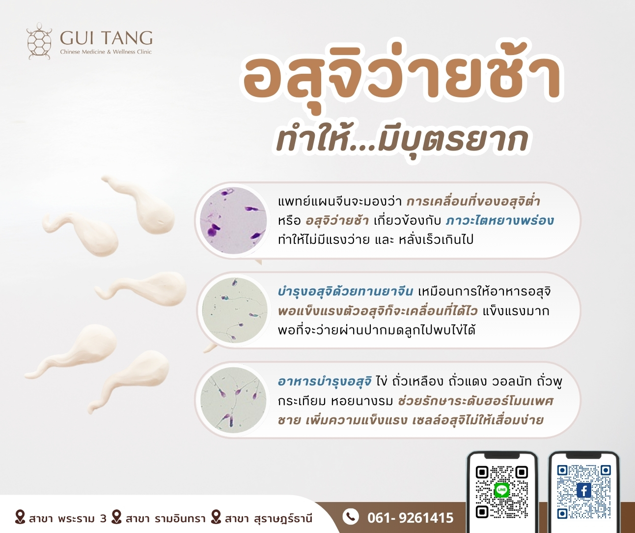 อสุจิว่ายช้า...ทำให้มีบุตรยาก