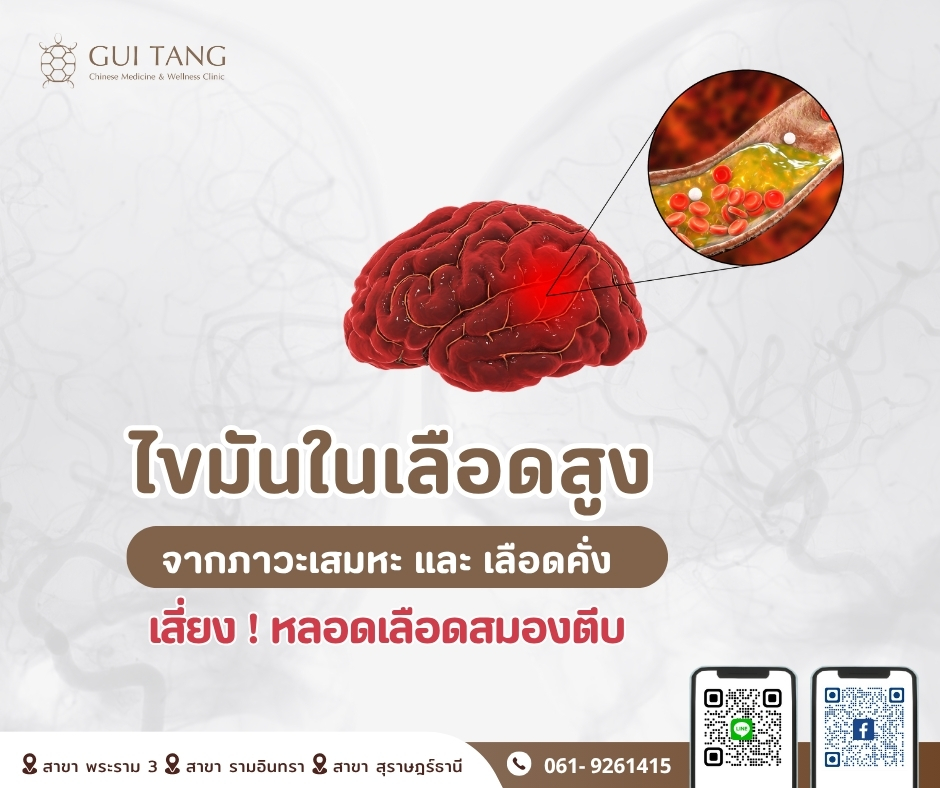 ไขมันในเลือดสูง จากภาวะเสมหะและเลือดคั่ง  เสี่ยง ! หลอดเลือดสมองตีบ