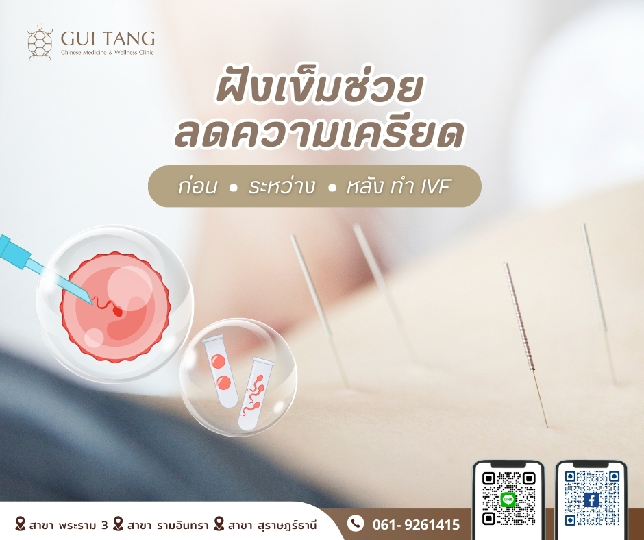 ฝังเข็มช่วยลดความเครียดก่อน–ระหว่าง–หลังทำ IVF
