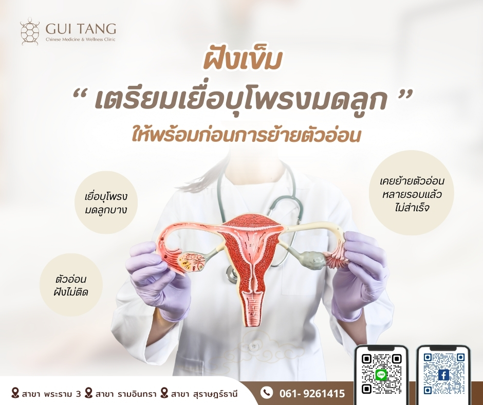 ฝังเข็มเตรียมเยื่อบุโพรงมดลูกให้พร้อม ก่อนการย้ายตัวอ่อน