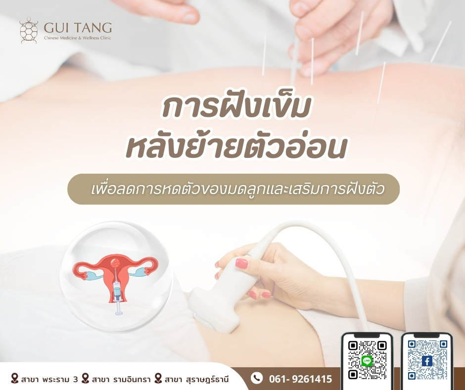 การฝังเข็มหลังย้ายตัวอ่อน เพื่อลดการหดตัวของมดลูกและเสริมการฝังตัว