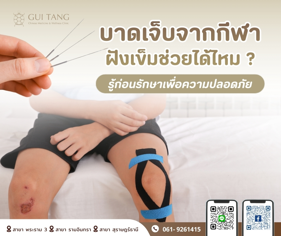 บาดเจ็บจากกีฬา ฝังเข็มช่วยได้ไหม ?