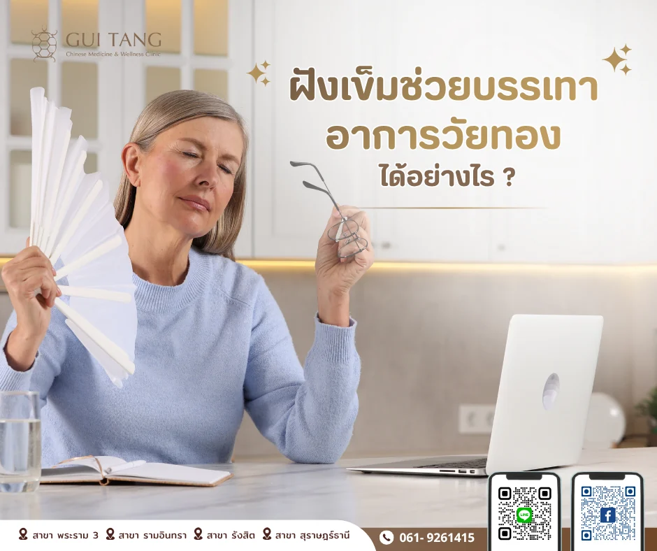 ฝังเข็มช่วยบรรเทาอาการวัยทองได้อย่างไร