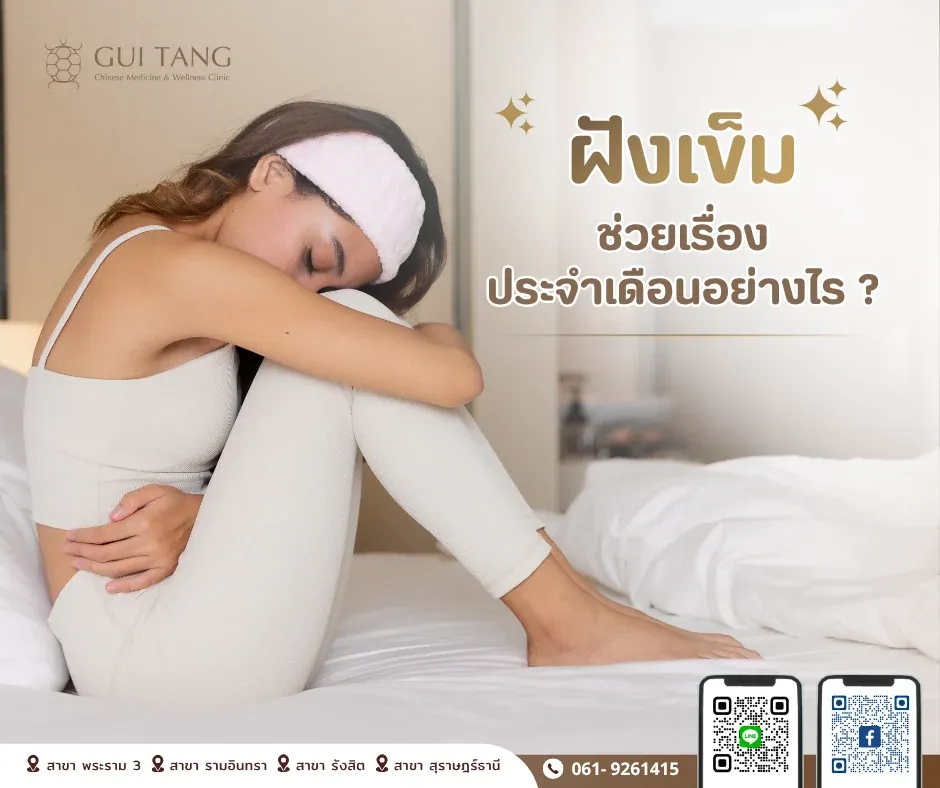 ฝังเข็มช่วยเรื่องประจำเดือนอย่างไร? ทางเลือกดูแลสุขภาพสตรีด้วยแพทย์แผนจีน — กุยถัง เวลเนส