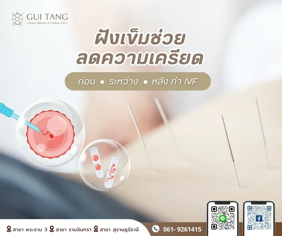 ฝังเข็มช่วยลดความเครียดก่อน–ระหว่าง–หลังทำ IVF