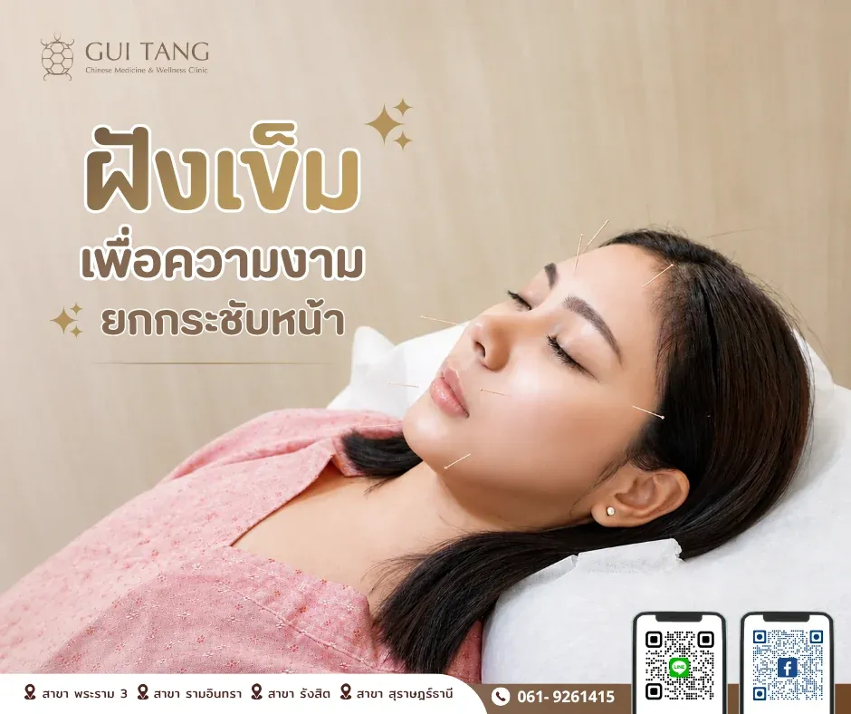 ฝังเข็มเพื่อความงาม ยกกระชับหน้า — กุยถัง เวลเนส