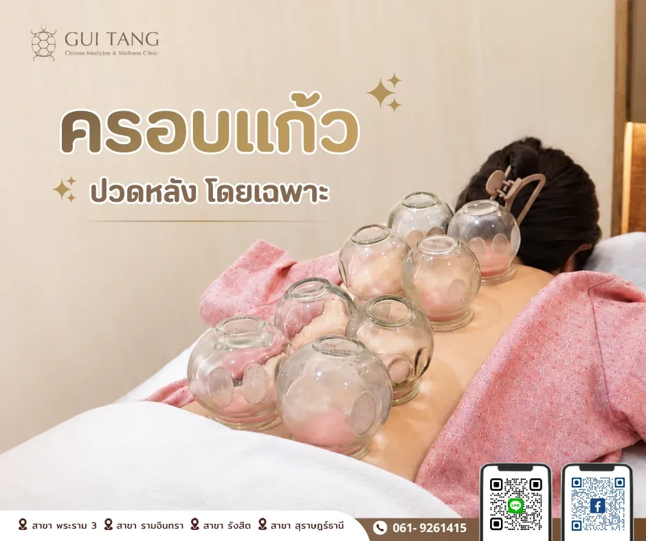 ครอบแก้วแก้ปวดหลัง ช่วยบรรเทาอาการปวดหลังได้อย่างไร — กุยถัง เวลเนส