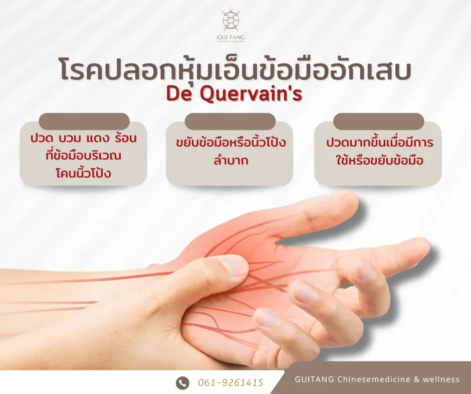 โรคปลอกหุ้มเส้นเอ็นบริเวณข้อมืออักเสบ (De Quervain's)