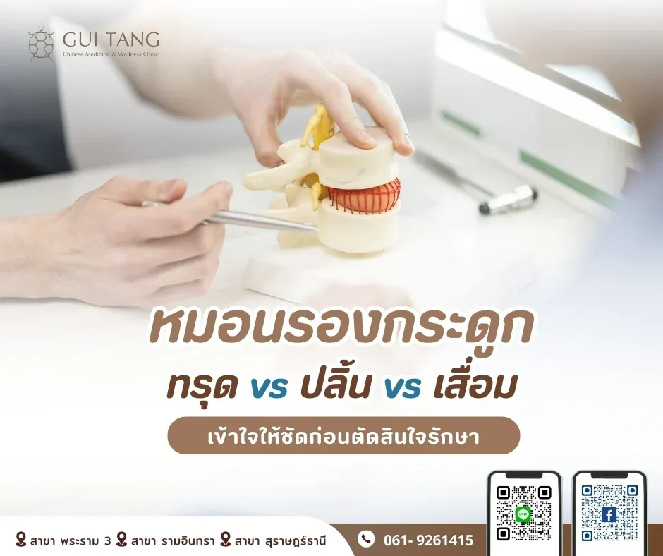 หมอนรองกระดูกทรุด vs หมอนรองกระดูกปลิ้น vs หมอนรองกระดูกเสื่อม