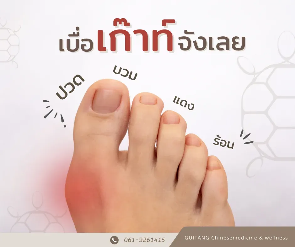 โรคเก๊าท์ (Gout)