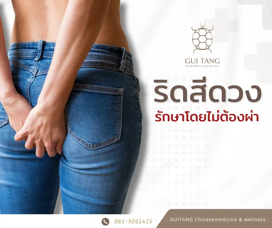 ริดสีดวงทวาร รักษาโดยไม่ต้องผ่า