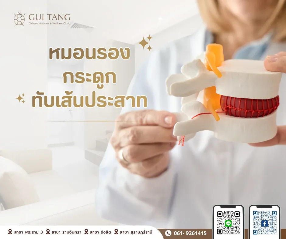 หมอนรองกระดูกทับเส้นประสาท รักษาด้วยแพทย์แผนจีนและฝังเข็มได้อย่างไร — กุยถัง เวลเนส
