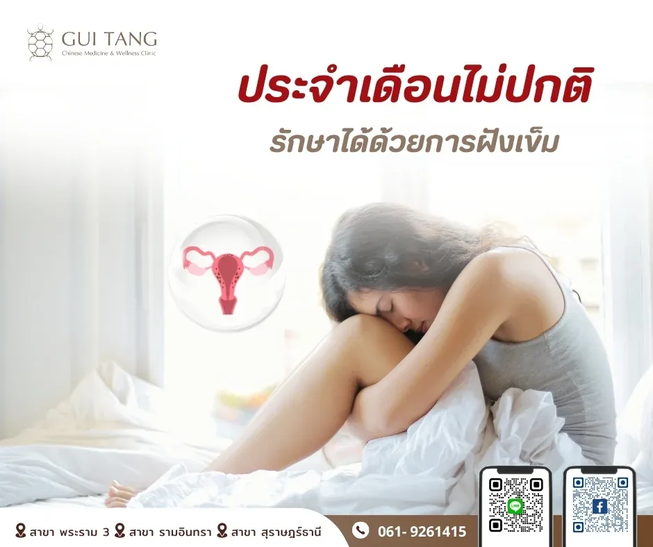 ประจำเดือนไม่ปกติ รักษาได้ด้วยการฝังเข็ม