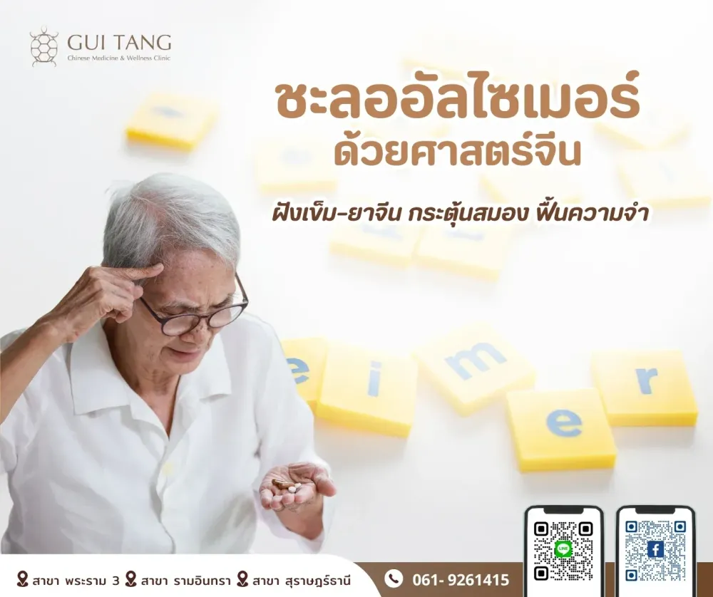 “ชะลออัลไซเมอร์ ด้วยศาสตร์จีน: ฝังเข็ม–ยาจีน กระตุ้นสมอง ฟื้นความจำ”