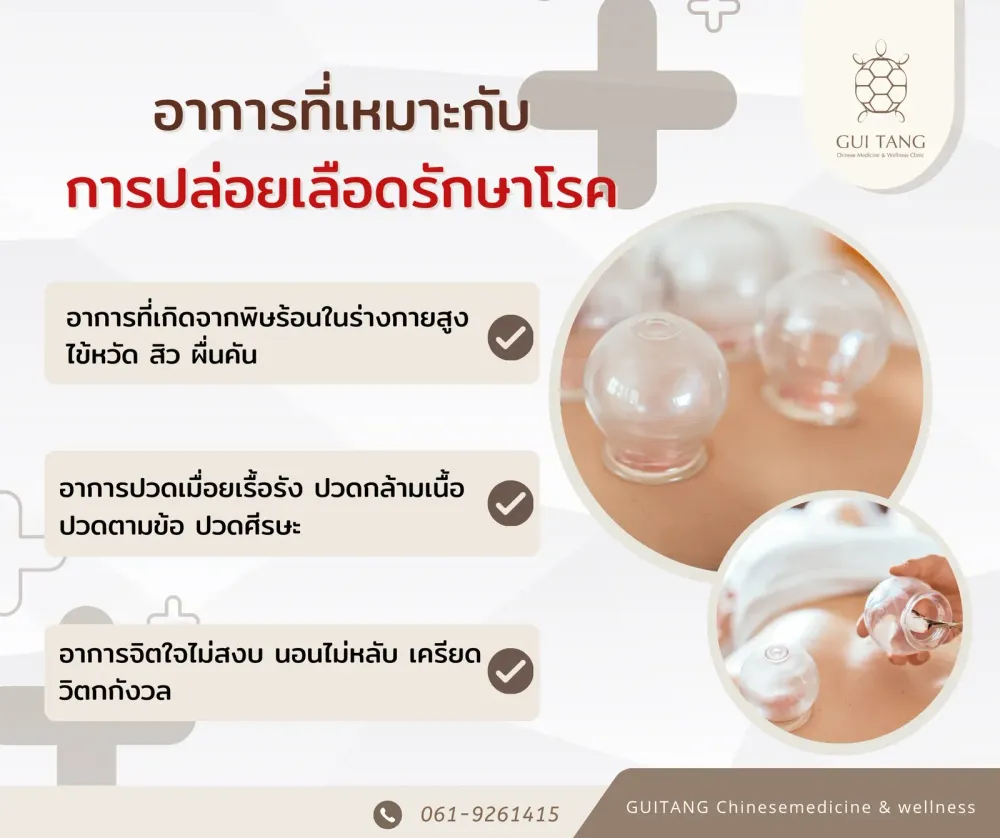การปล่อยเลือดรักษาโรคและข้อควรระวัง
