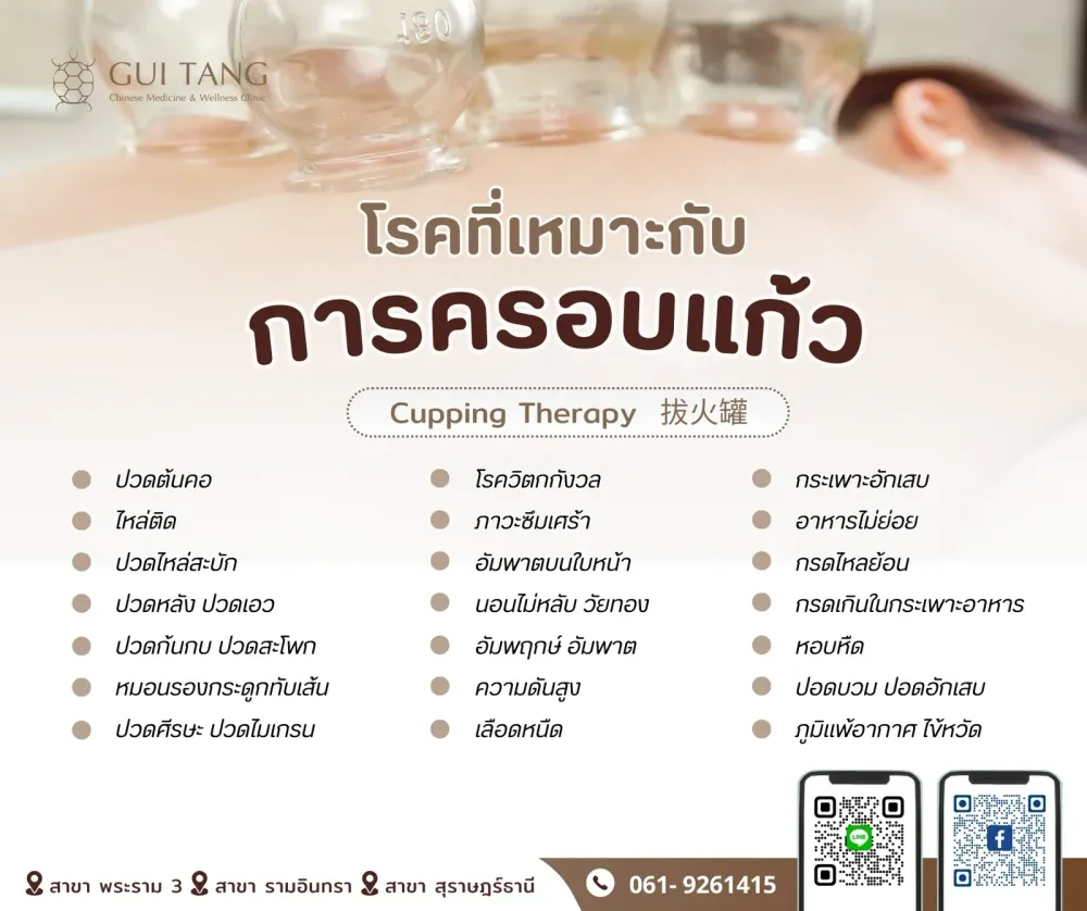 โรคที่เหมาะกับการครอบแก้ว (Cupping Therapy)