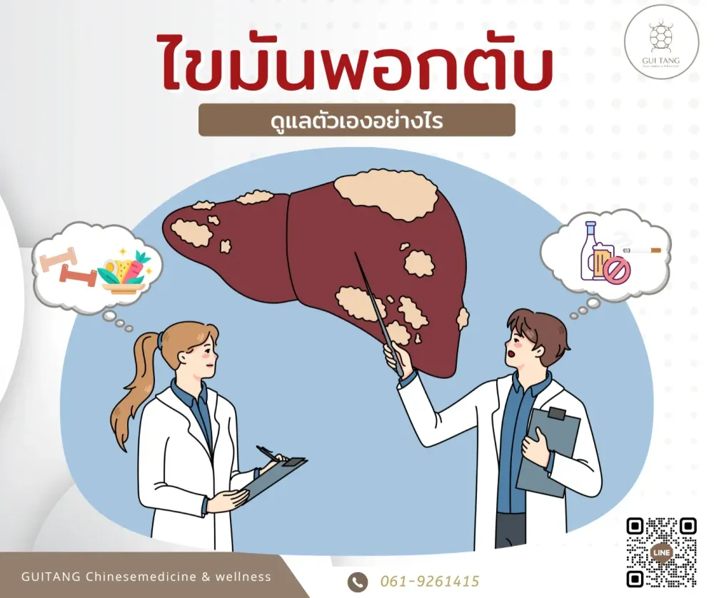 ไขมันพอกตับ (Fatty Liver Disease)