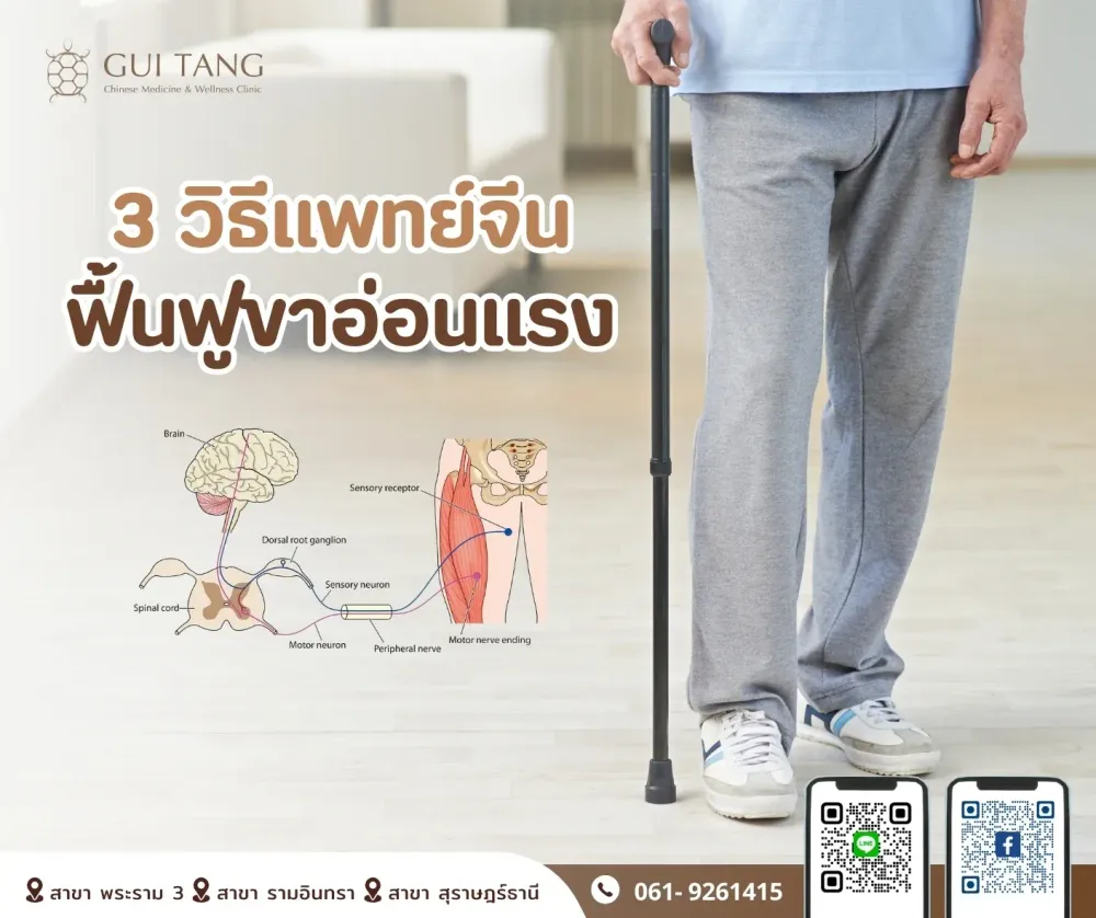 “3 วิธีแพทย์จีนฟื้นฟูขาอ่อนแรง”