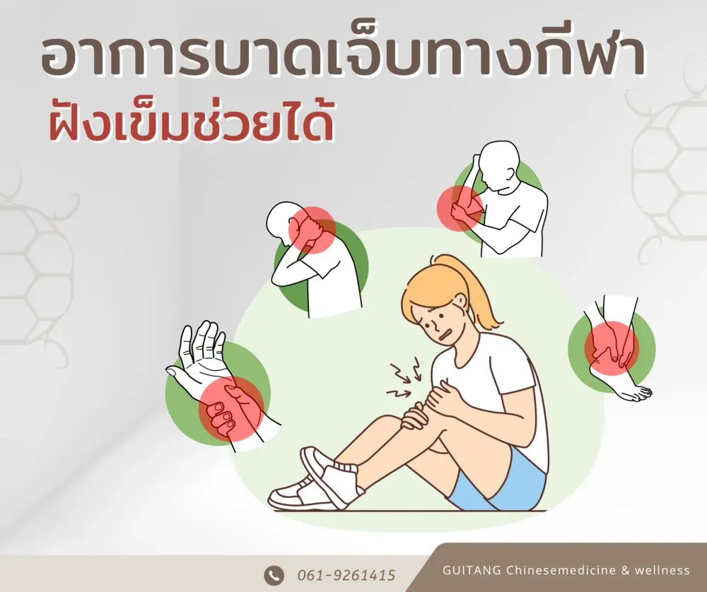 บาดเจ็บจากกีฬา ฝังเข็มได้ไหม