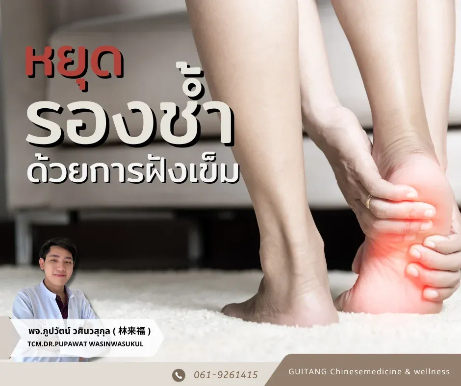 โรครองช้ำ