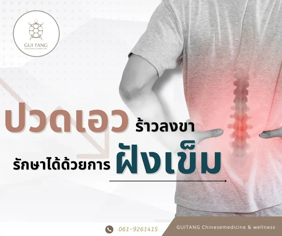 ปวดเอวร้าวลงขา รักษาอย่างไร