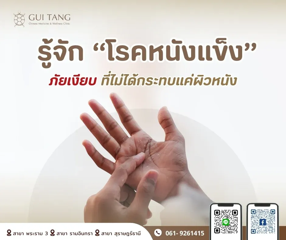 รู้จัก “โรคหนังแข็ง” ภัยเงียบที่ไม่ได้กระทบแค่ผิวหนัง