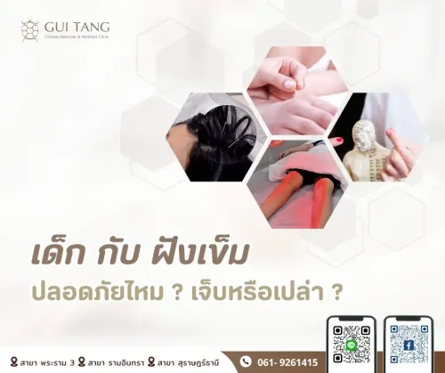 เด็กกับฝังเข็ม: ปลอดภัยไหม? เจ็บหรือเปล่า?