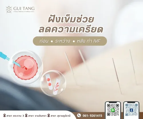 ฝังเข็มช่วยลดความเครียดก่อน–ระหว่าง–หลังทำ IVF