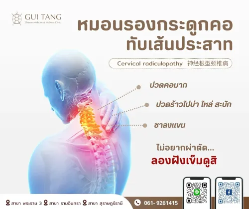 หมอนรองกระดูก “คอ” กดทับเส้นประสาท
