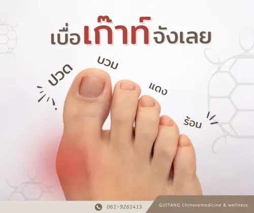 โรคเก๊าท์ (Gout)