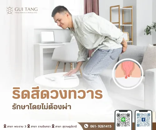 ริดสีดวงทวาร รักษาโดยไม่ต้องผ่า