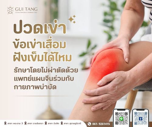 ปวดเข่า ข้อเข่าเสื่อม ฝังเข็มได้ไหม รักษาโดยไม่ผ่าตัดด้วยแพทย์แผนจีนร่วมกับกายภาพบำบัด