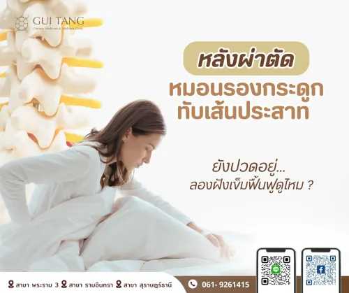 “หลังผ่าหมอนรองกระดูก ยังปวดอยู่…ลองฝังเข็มฟื้นฟูดูไหม?”