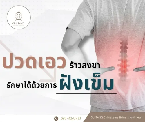 ปวดเอวร้าวลงขา รักษาอย่างไร