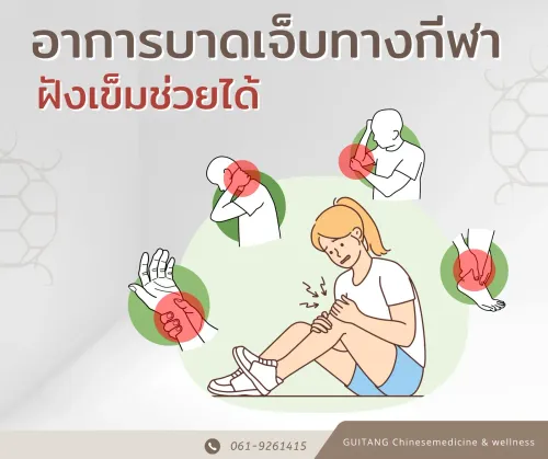 บาดเจ็บจากกีฬา ฝังเข็มได้ไหม