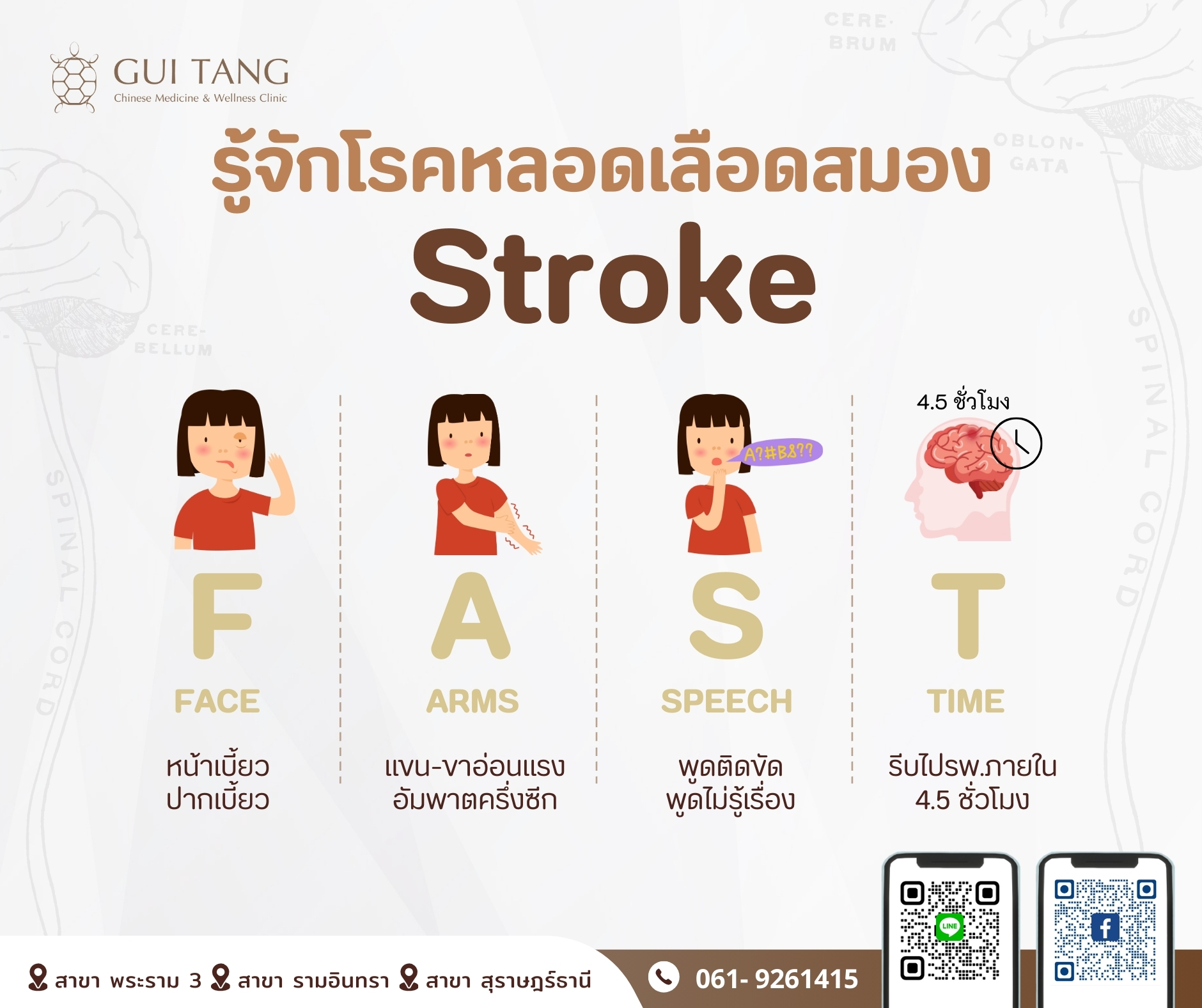 รู้จักโรคหลอดเลือดสมอง “Stroke”