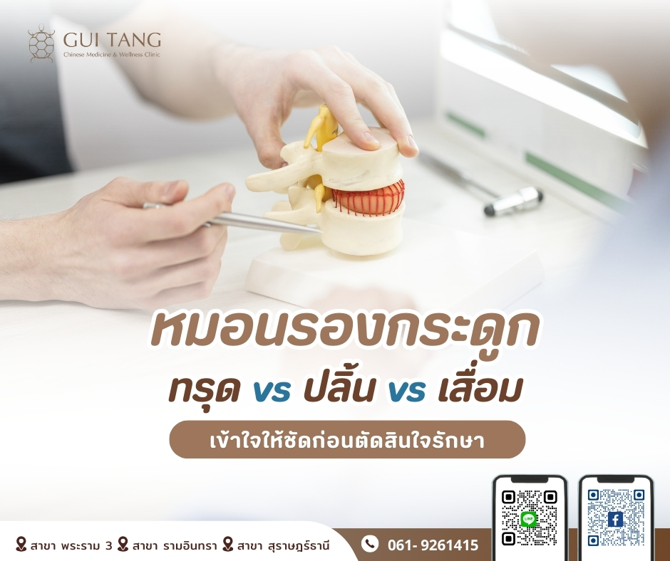 หมอนรองกระดูกทรุด vs หมอนรองกระดูกปลิ้น vs หมอนรองกระดูกเสื่อม