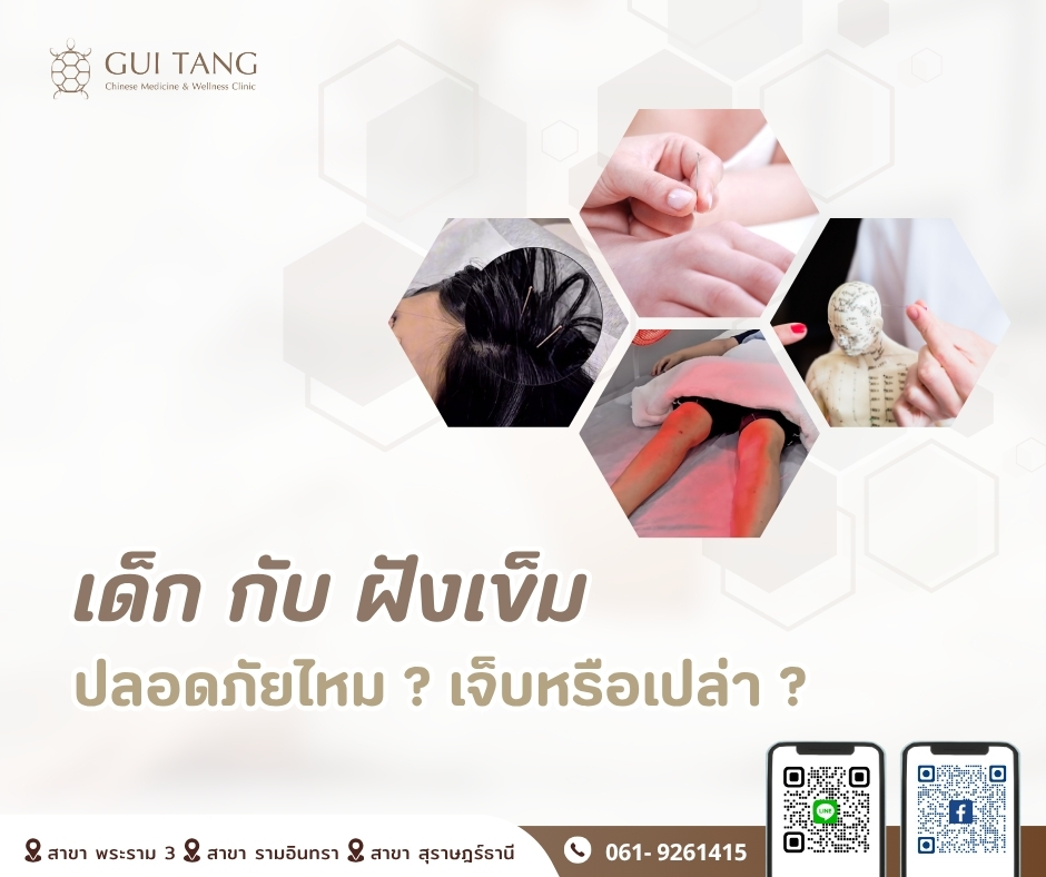 เด็กกับฝังเข็ม: ปลอดภัยไหม? เจ็บหรือเปล่า?