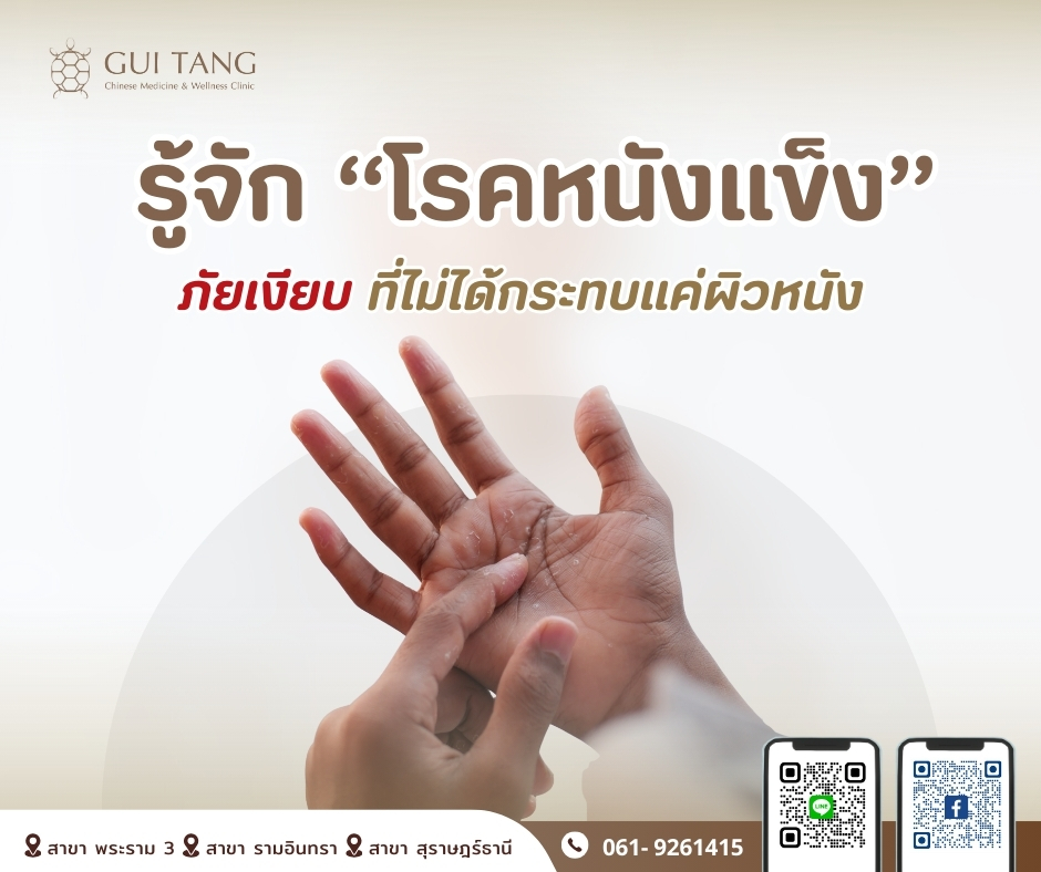 รู้จัก “โรคหนังแข็ง” ภัยเงียบที่ไม่ได้กระทบแค่ผิวหนัง